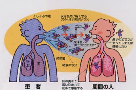 図：せきからの感染ルート