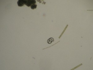 画像：１０月7日 アオコ顕微鏡写真1