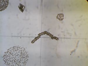 画像 : アオコ顕微鏡写真（三倉鼻）の写真